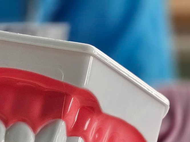 신경치료 후 통증이 생기는 이유 관련 이미지 17