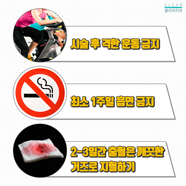 강남클리어치과에서 알려주는 임플란트 주의사항! 관련 이미지 2