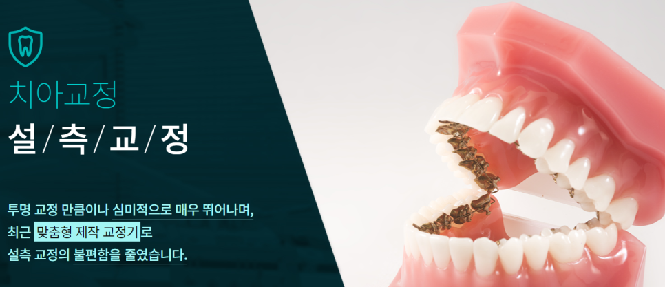 도곡동교정치과 티나지 않게 하고 싶다면 관련 이미지 6