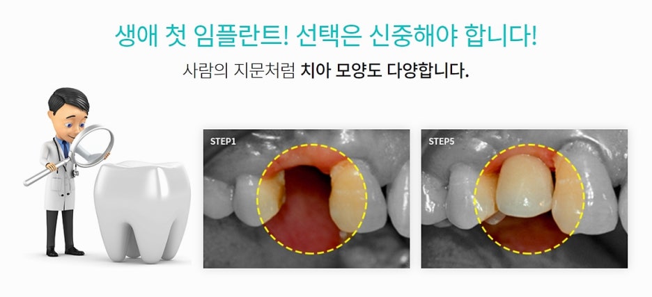 강남 임플란트치과 상황을 봐가면서 관련 이미지 7