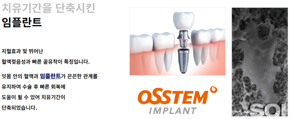 임플란트치과병원 강남 실력좋은 곳 찾는다면 관련 이미지 7
