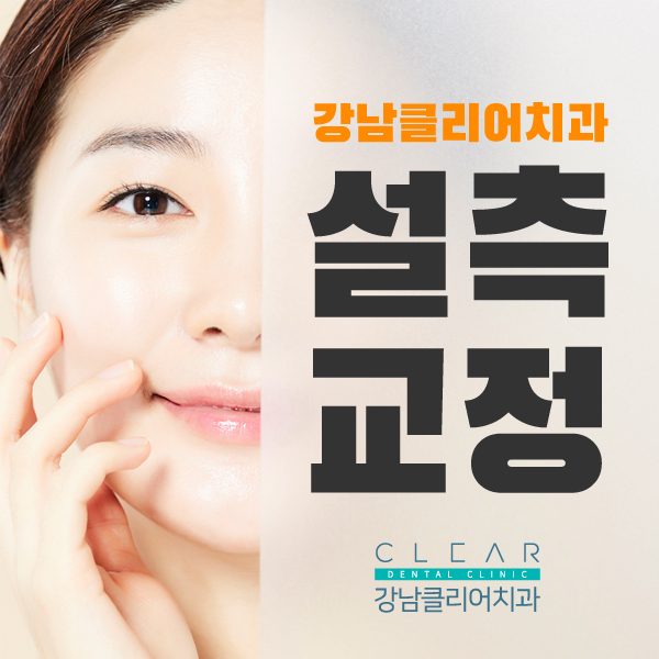강남역 안보이는 시크릿교정 설측교정! 관련 이미지 1
