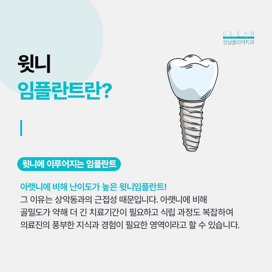 강남클리어치과 상악동에 주목해야해요 관련 이미지 3