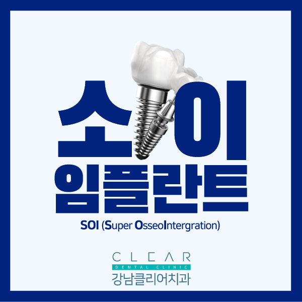 강남임플란트잘하는치과 SOI(소이) 임플란트 첫 도입 이벤트 관련 이미지 1