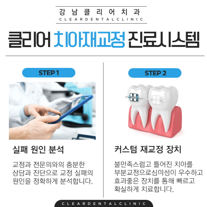 강남 치아재교정 치과 빠르고 확실하게 관련 이미지 4