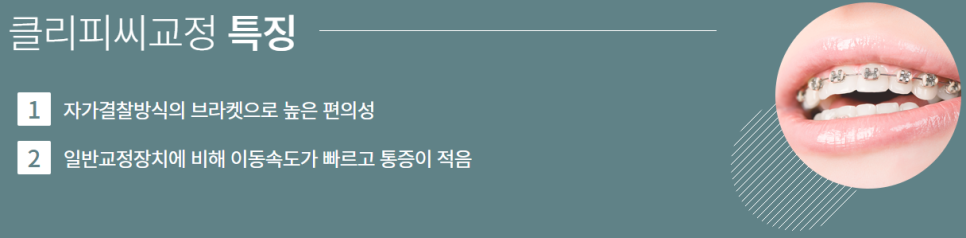 역삼동 부정교합 어떤 치료를 해야 할까? 관련 이미지 7