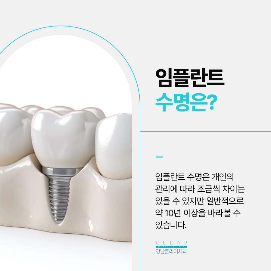 임플란트 구조 수명은 어느정도? 관련 이미지 2