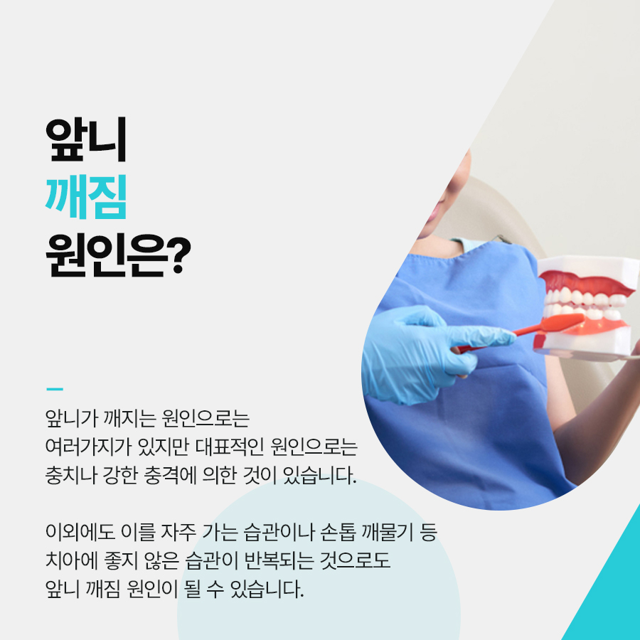 치아레진치료 앞니 깨짐 개선방법으로 관련 이미지 2