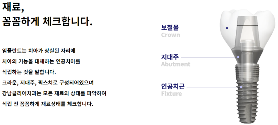서울임플란트잘하는치과 개인에 따라 맞춤 식립으로 관련 이미지 5