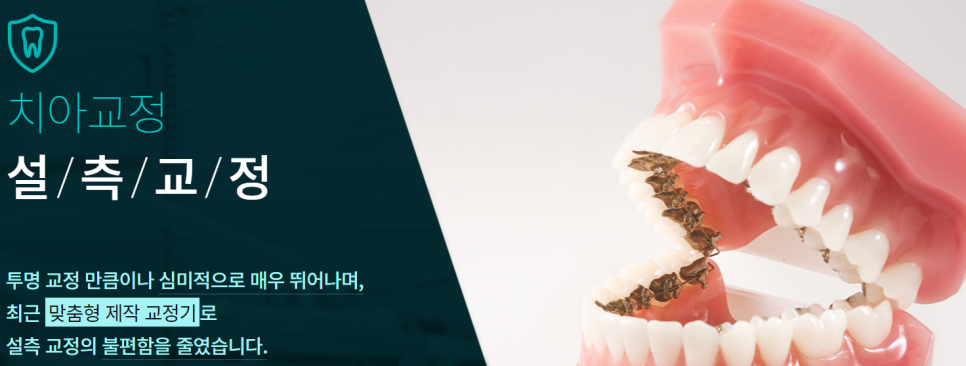 서초동교정치과 반듯한 치아가 부럽다면? 관련 이미지 3