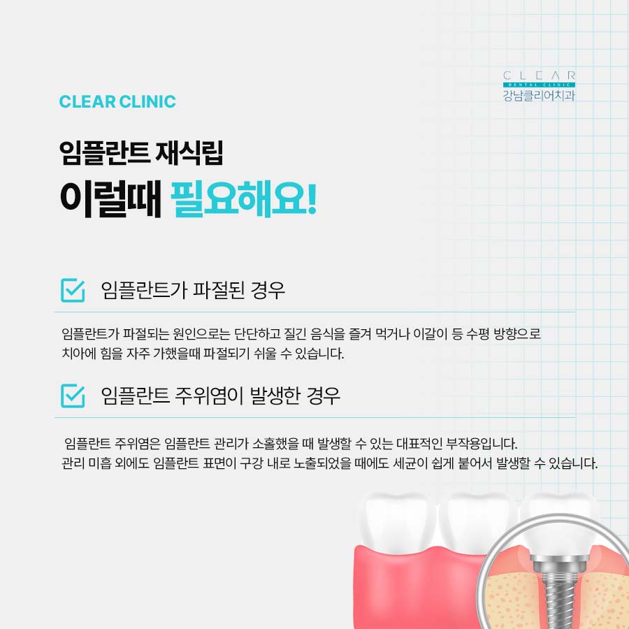 임플란트 재식립 필요한 경우 주의사항은 관련 이미지 2