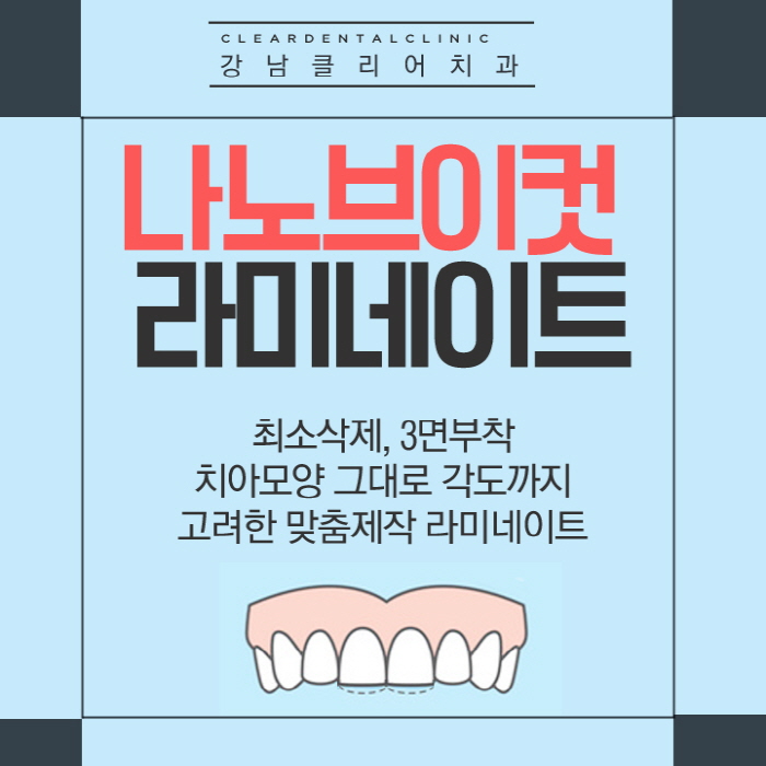 최소삭제라미네이트 클리어 V컷라미 나노네이트 관련 이미지 1