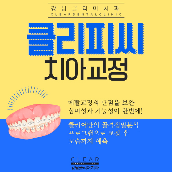 클리피씨교정 비용, 가격 정품클리피씨교정 특징 관련 이미지 1