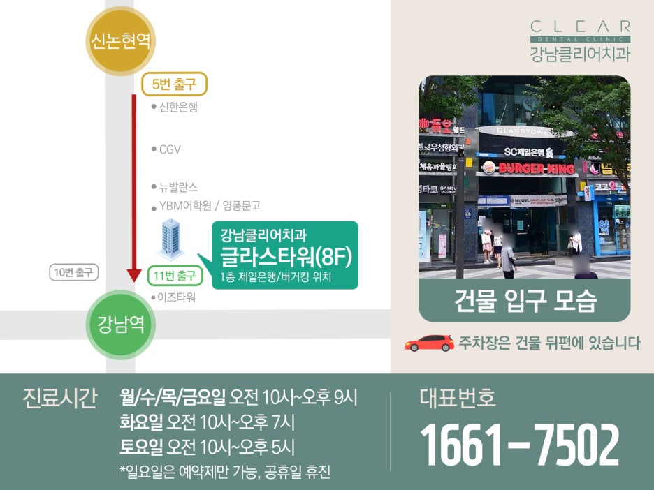 논현동 임플란트 식립 중요한 것은? 관련 이미지 16