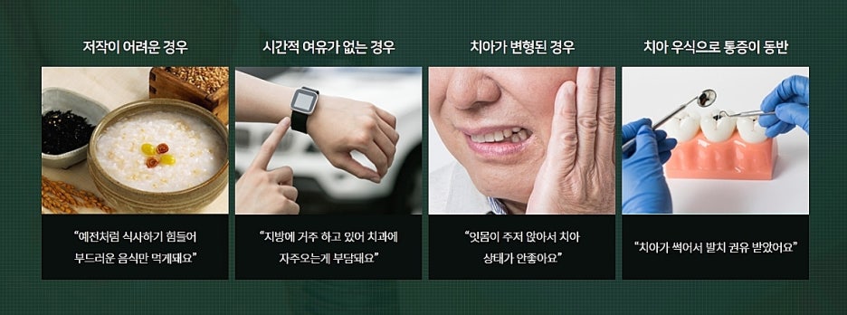 서울 임플란트치과 어디로 가볼까 관련 이미지 7
