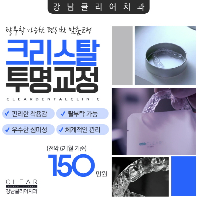 원데이치아미백 치과 치아미백 이벤트로 착한가격까지 관련 이미지 9