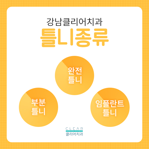 제2의 치아 틀니, 틀니가 무엇인가요? 관련 이미지 2