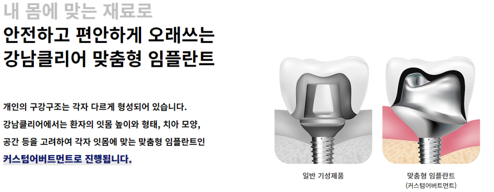 도곡동임플란트치과 불편함 없이 오래도록 사용 가능한 관련 이미지 7