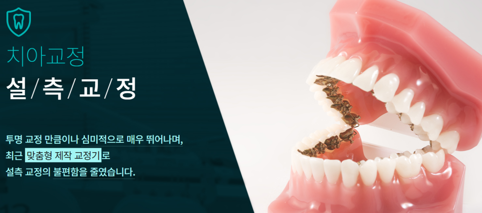 논현동치아교정 틀어진 정도 파악이 우선 관련 이미지 7