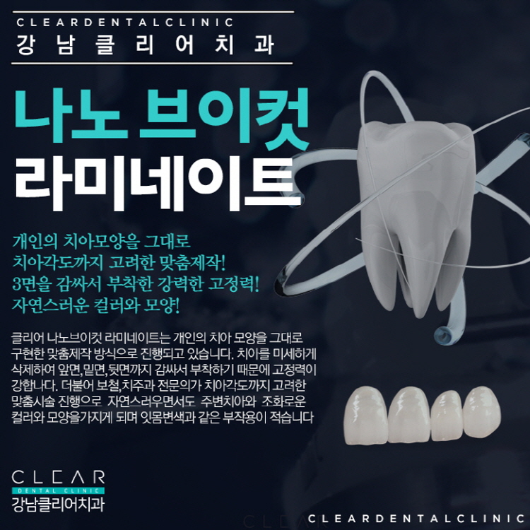 강남라미네이트 앞뒤옆까지 확실하게하자! 관련 이미지 4