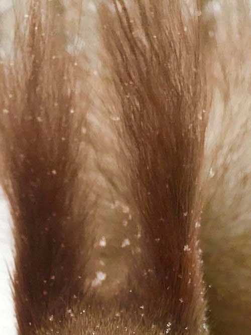 역삼동 임플란트 치과 유지기간 오래 쓰려면 주의사항 관련 이미지 36