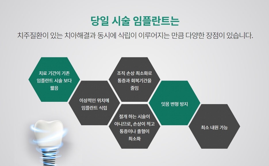 원데이임플란트 관심이 생겼을 경우 관련 이미지 5