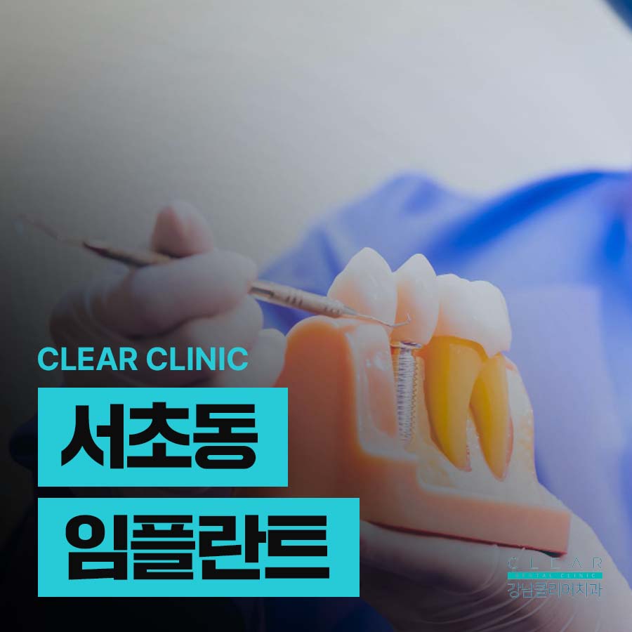 서초동 임플란트 깨끗하게 클리어하게 관련 이미지 1