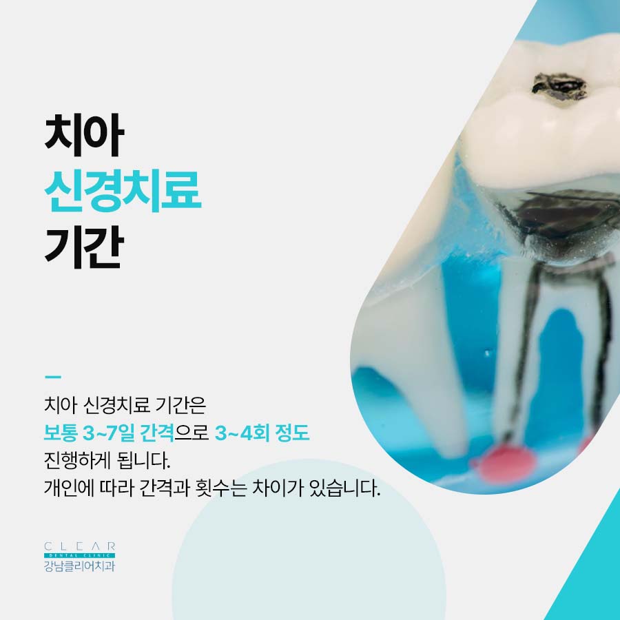 강남클리어치과 신경치료 필요할때 증상 기간은? 관련 이미지 4