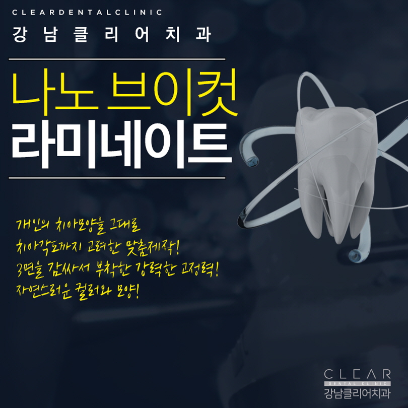 강남역라미네이트 나에게 어울리는 예쁜치아 만들기 관련 이미지 4