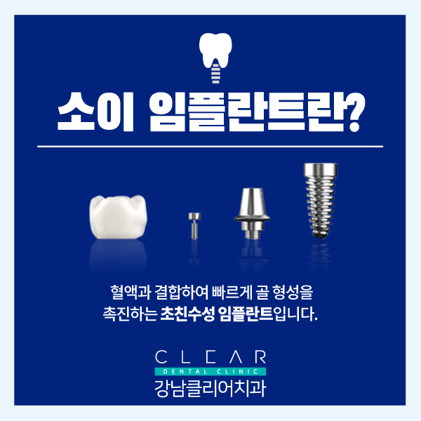 강남임플란트잘하는치과 SOI(소이) 임플란트 첫 도입 이벤트 관련 이미지 2