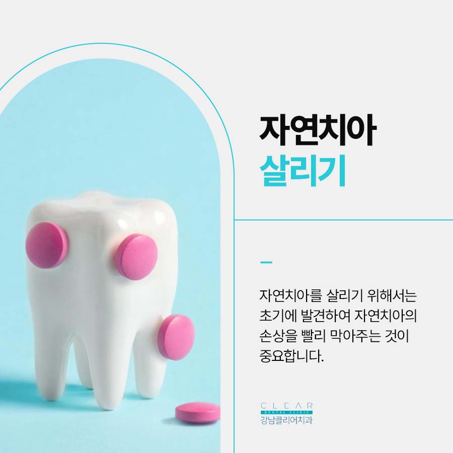자연치아살리기 신경치료 시기 놓치면 안되는 이유 관련 이미지 3