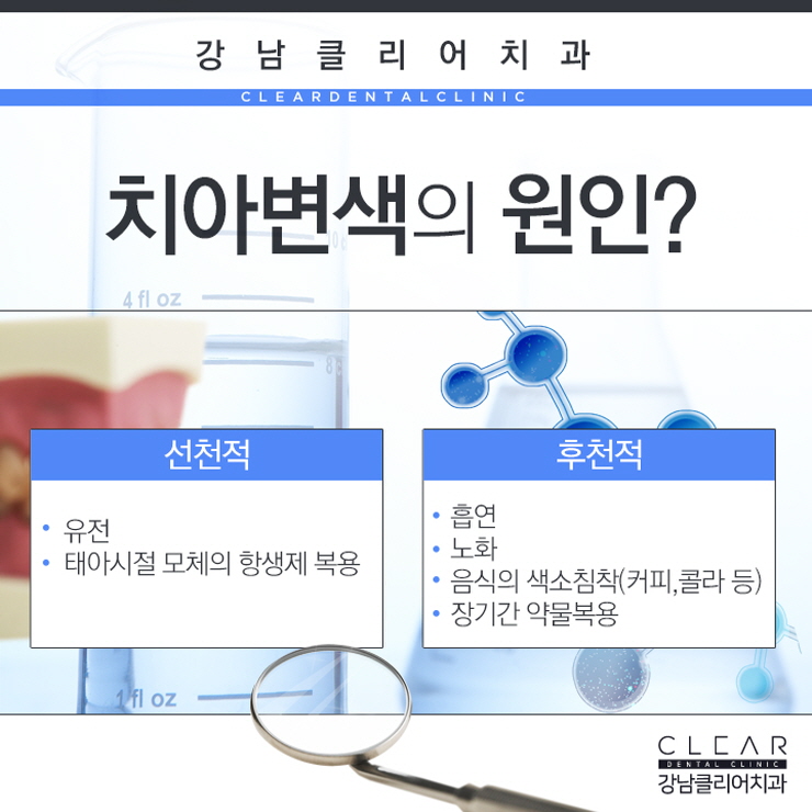 강남치아미백 미백단계까지 조절가능한 치과치아미백 관련 이미지 4