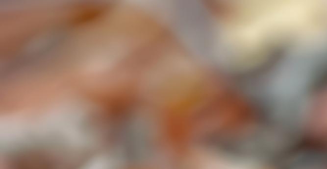 임플란트 정품 확인하고 내게 맞는 식립방법으로 관련 이미지 15