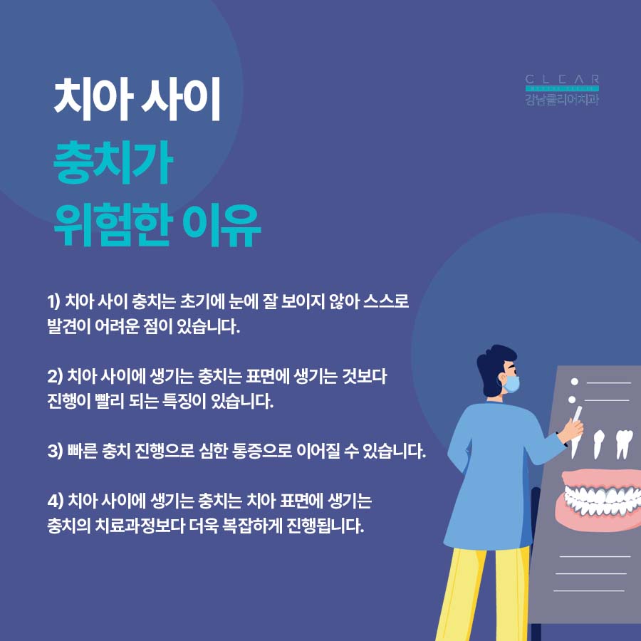 치아 사이 충치 원인 치료방법 정리해봐요 관련 이미지 3