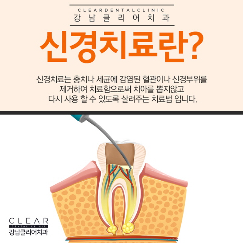 강남역충치치료 걱정보단 빠른 치료가 중요 관련 이미지 6