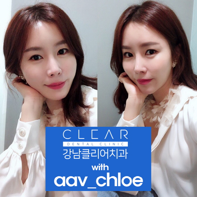 강남역라미네이트 완벽맞춤 나노브이컷 라미네이트 관련 이미지 12