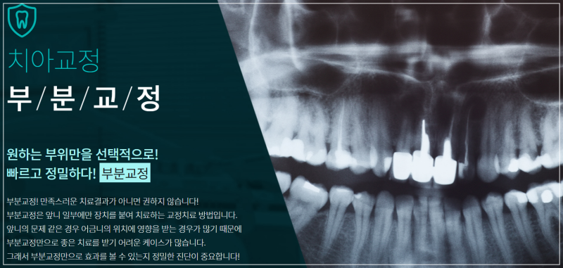 도곡동교정치과 만족스러운 에프터 관련 이미지 8