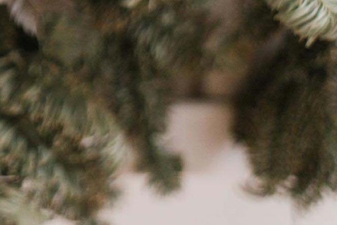 라미네이트 치아삭제 꼭 필요한 만큼만 해요 관련 이미지 32