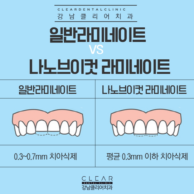 강남역라미네이트 완벽맞춤 나노브이컷 라미네이트 관련 이미지 6