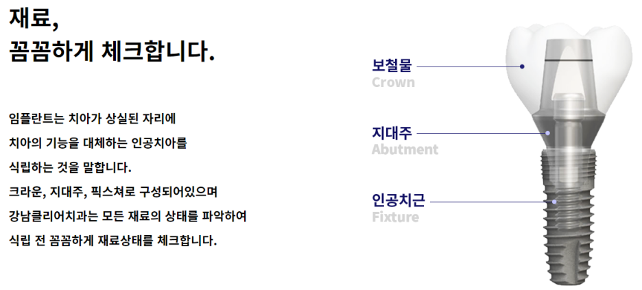 서울임플란트잘하는곳 섬세한 강남클리어치과! 관련 이미지 2