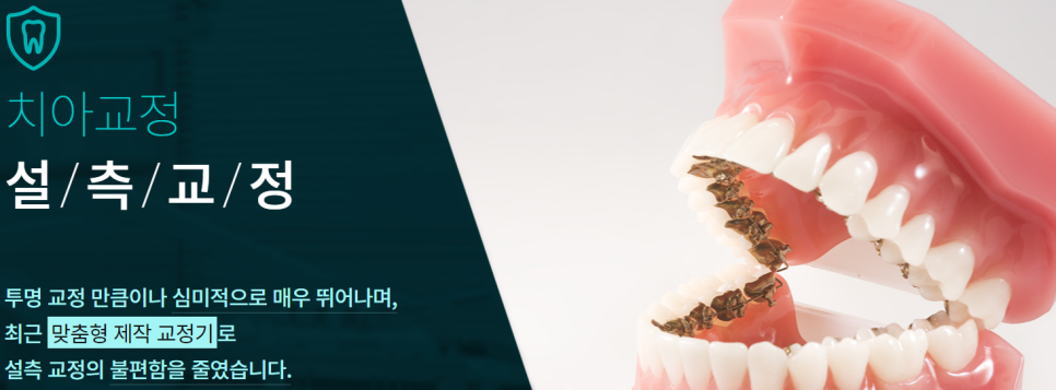 강남역 교정치과 치아배열이 콤플렉스라면 관련 이미지 5