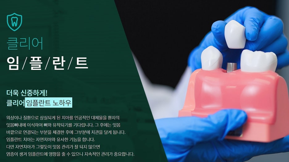 강남역 임플란트치과 소중함을 알고 관련 이미지 3