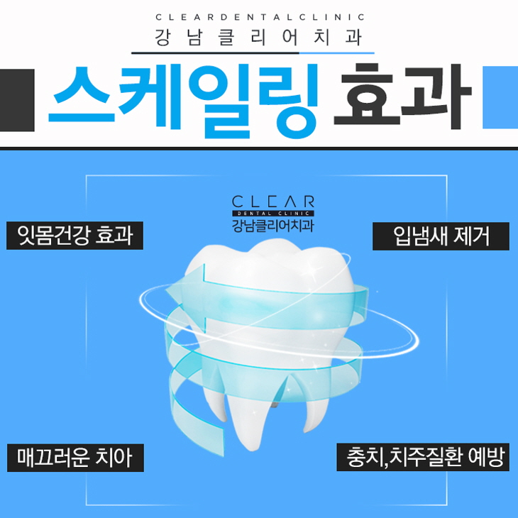 치아 스케일링 가격 의료보험 혜택 적용 관련 이미지 4