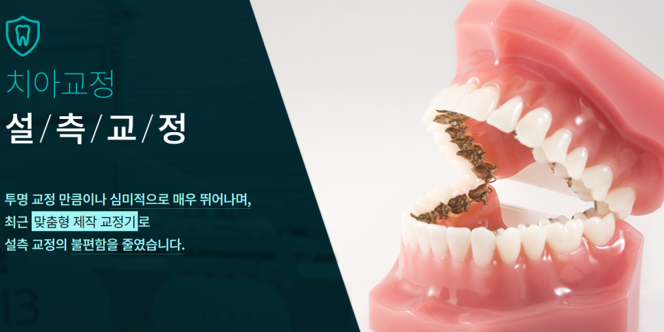 강남교정치과 치아라인을 반듯하게! 관련 이미지 3