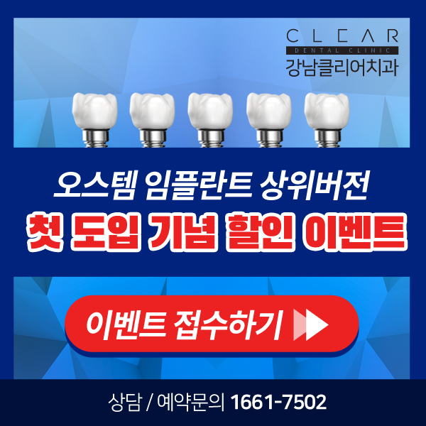 강남임플란트잘하는치과 SOI(소이) 임플란트 첫 도입 이벤트 관련 이미지 6