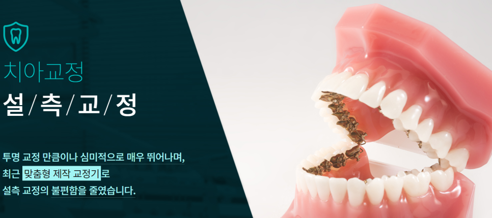 서울치아교정 잘하는 곳을 찾는 방법 관련 이미지 6