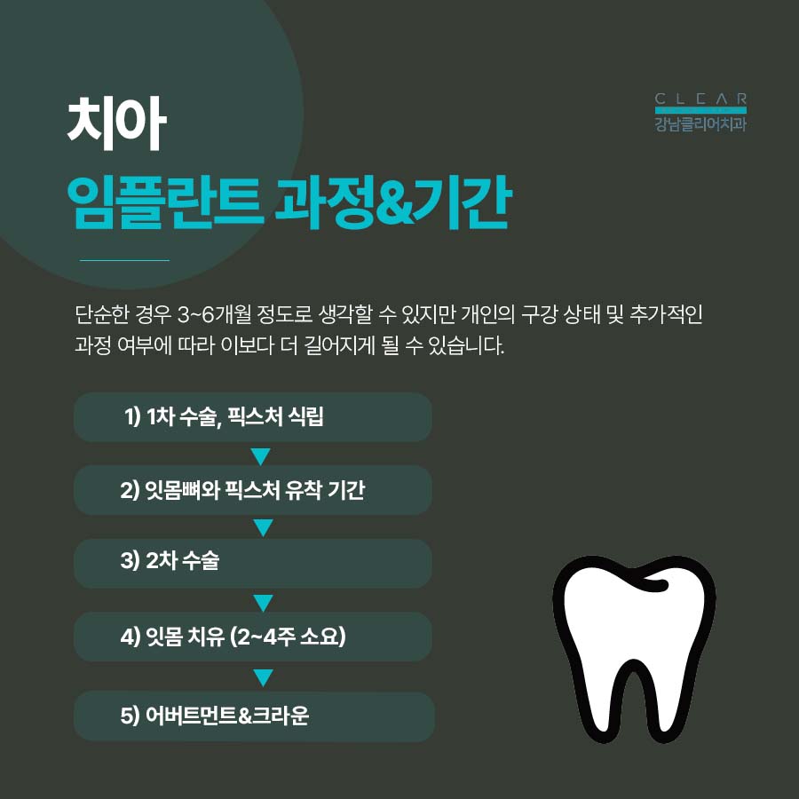 강남역 치과 임플란트 구조와 치료기간 관련 이미지 4