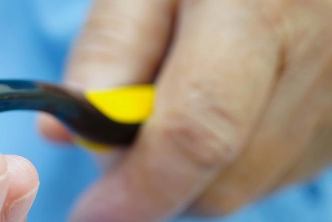 신경치료 후 통증이 생기는 이유 관련 이미지 29