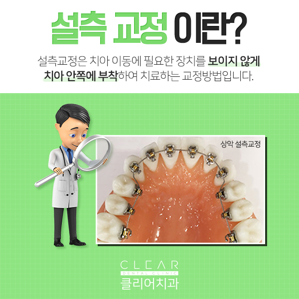 들어와봐~ 너에게만 비밀스런교정방법 알려줄게! 관련 이미지 3