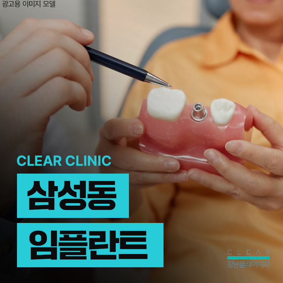 삼성동 임플란트 맞춤형 식립으로 튼튼하게 관련 이미지 1